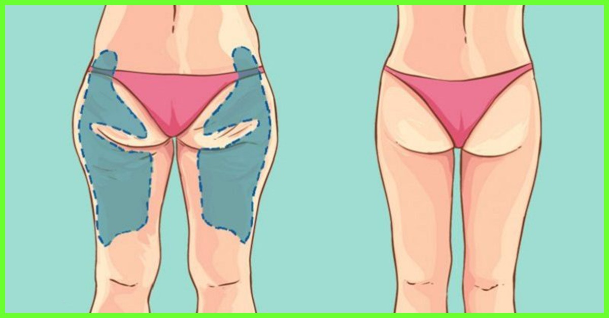 How to Lose Hip Fat